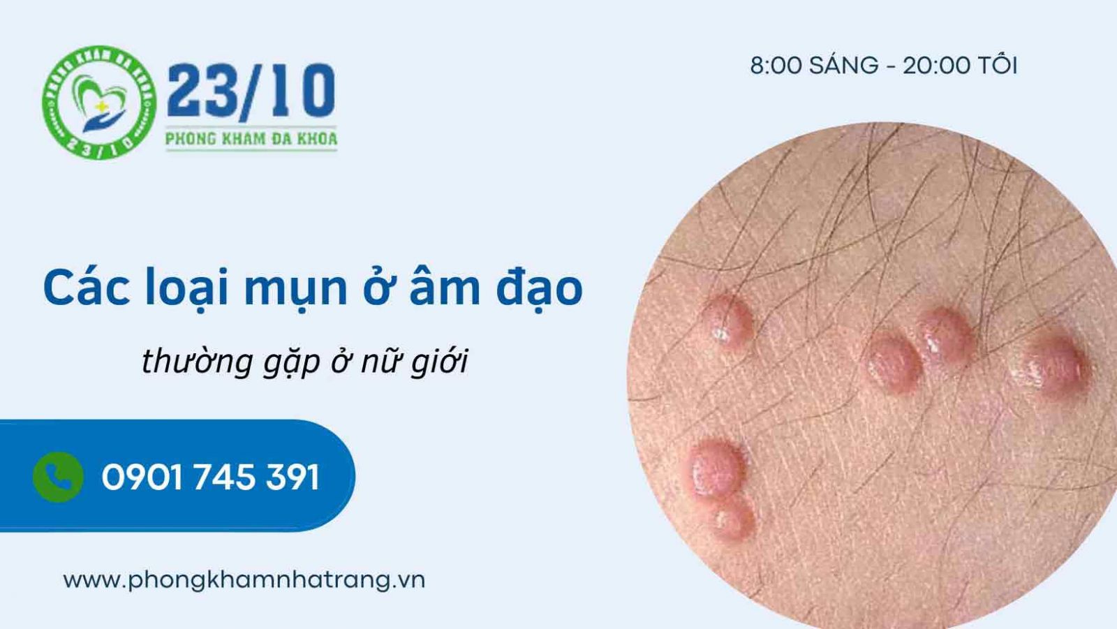 Các loại mụn ở âm đạo thường gặp nhất