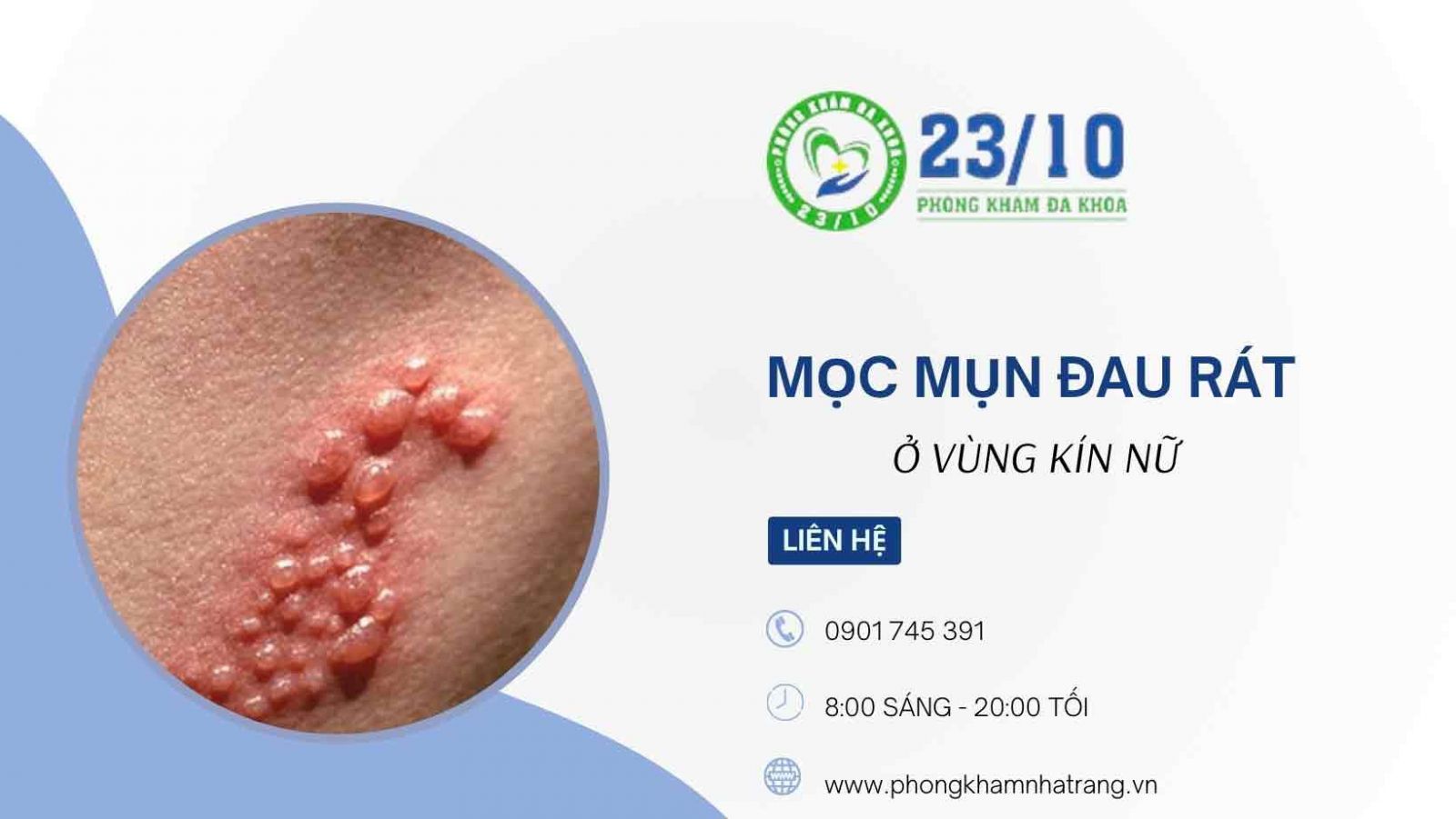 Thủ phạm gây ra mụn đau rát ở vùng kín