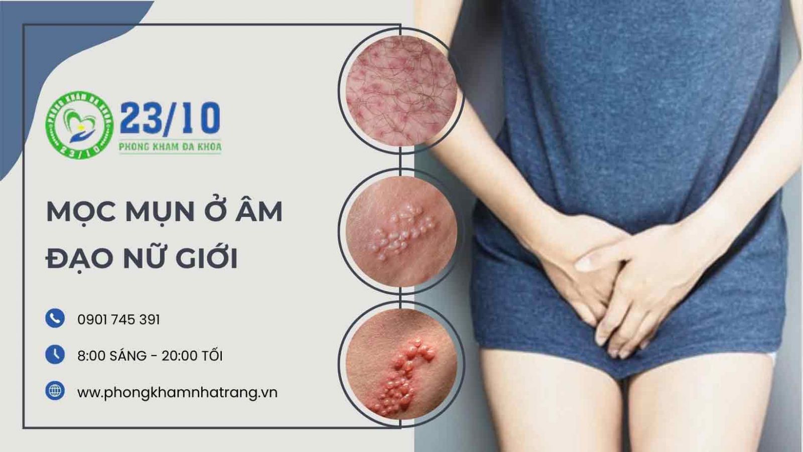 Đặc điểm nhận dạng của mụn cóc ở vùng kín