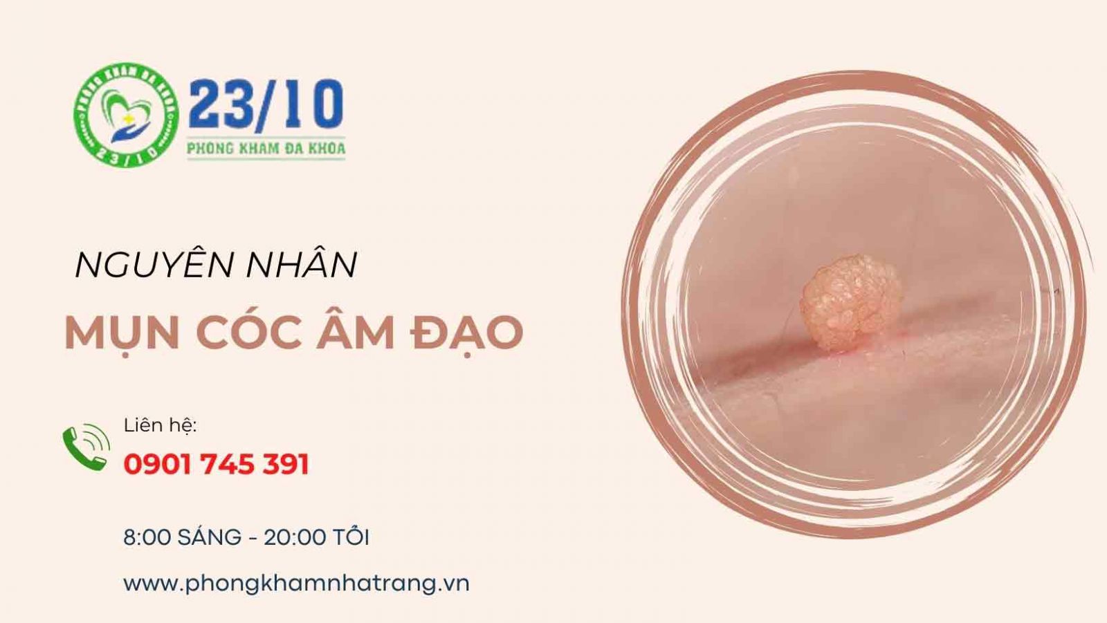 Bị mụn cóc âm đạo là do đâu?