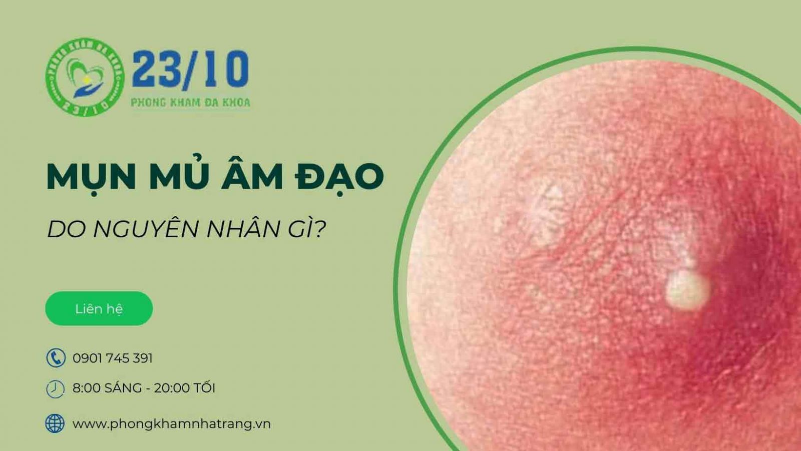 Mụn mủ âm đạo thường do những nguyên nhân nào?