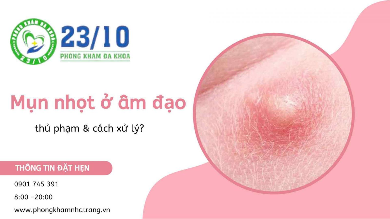 Do đâu mà xuất hiện mụn nhọt ở âm đạo?