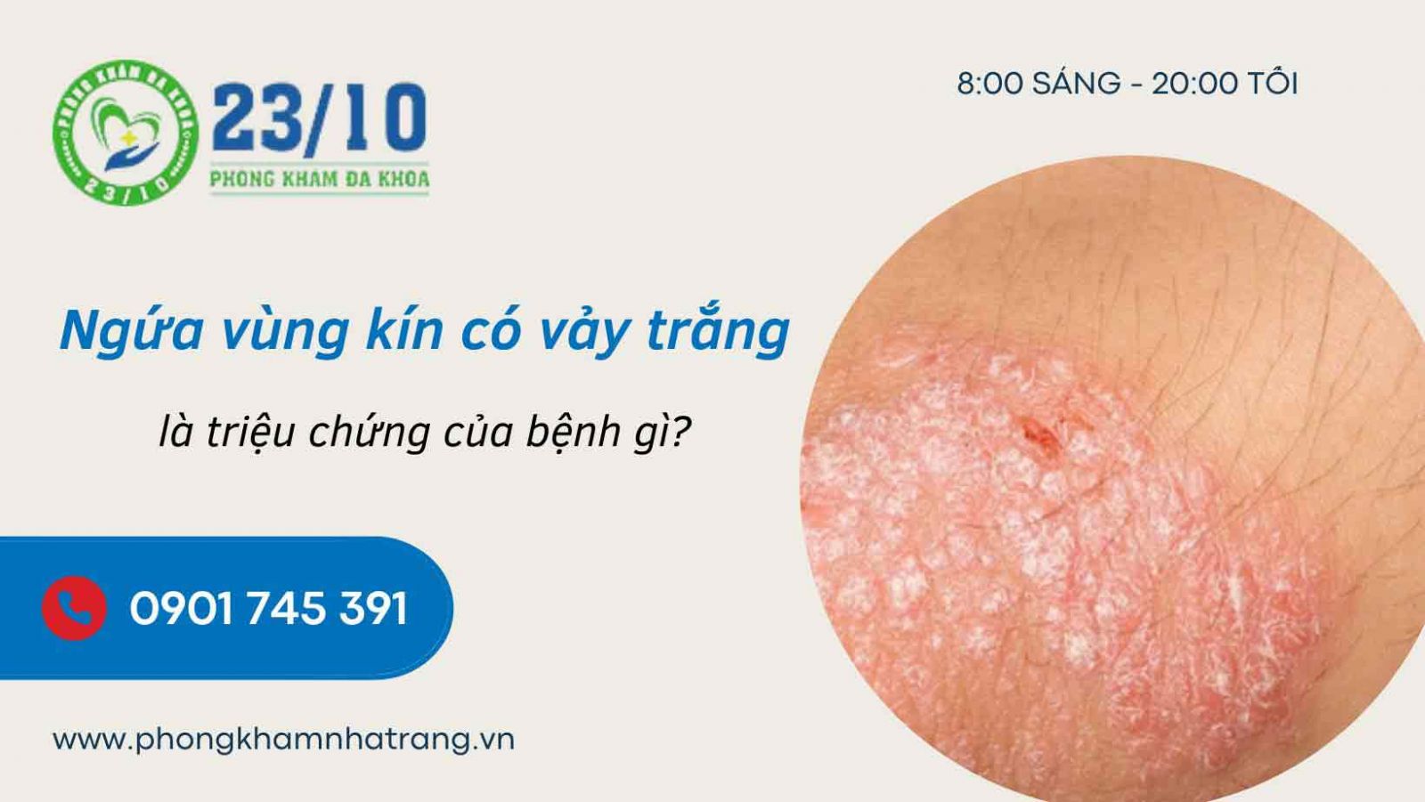  Các tác nhân gây ra tình trạng bị vảy trắng ở vùng kín