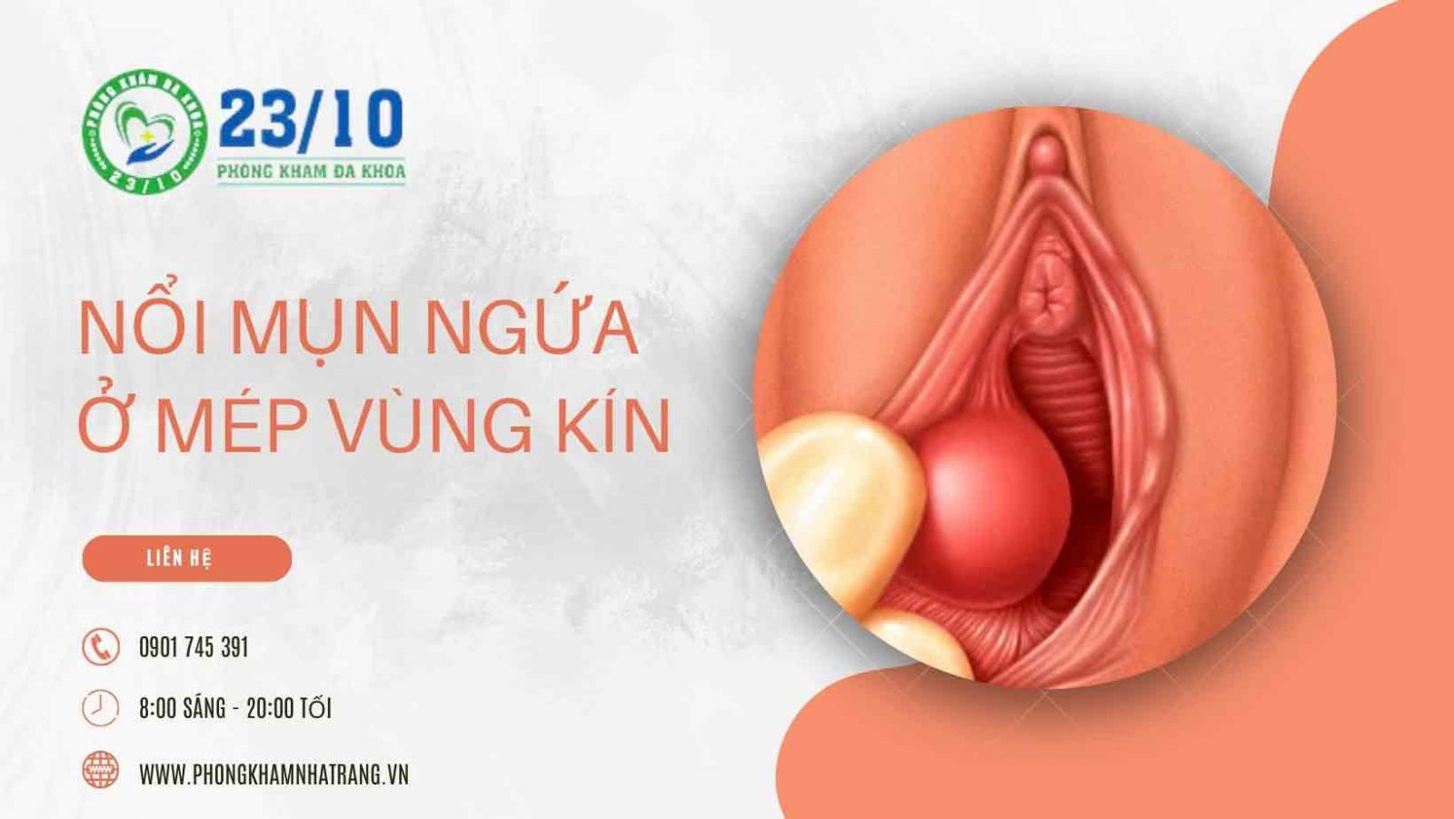 Nổi mụn ngứa ở mép vùng kín nữ là do đâu?