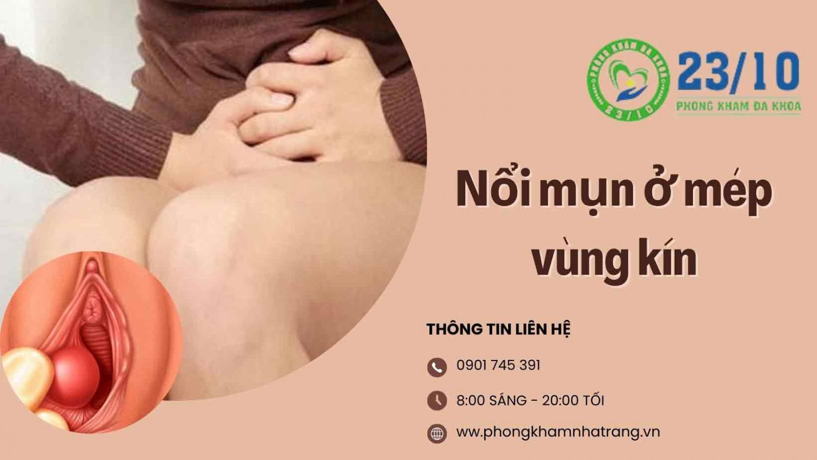 Thủ phạm gây nổi mụn ở mép vùng kín nữ