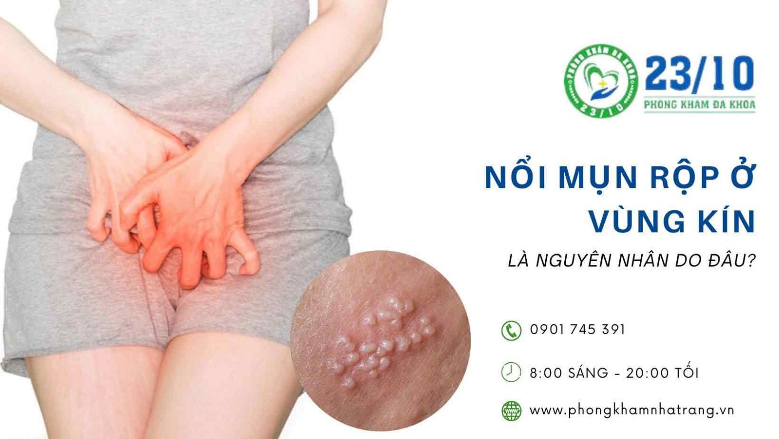Vùng kín bị nổi mụn rộp ở nữ là do nguyên nhân gì?