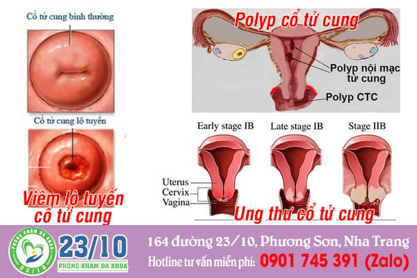 Các bệnh phụ khoa thường gặp