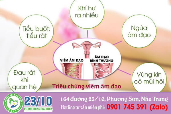 Các triệu chứng viêm âm đạo