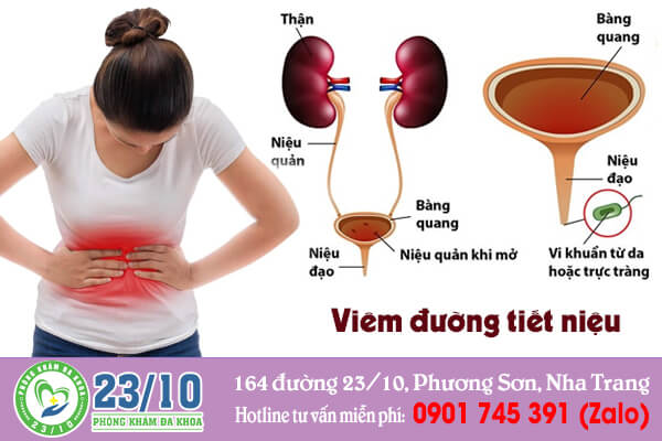 Viêm đường tiết niệu ở nữ