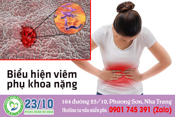 Biểu hiện của viêm phụ khoa nặng