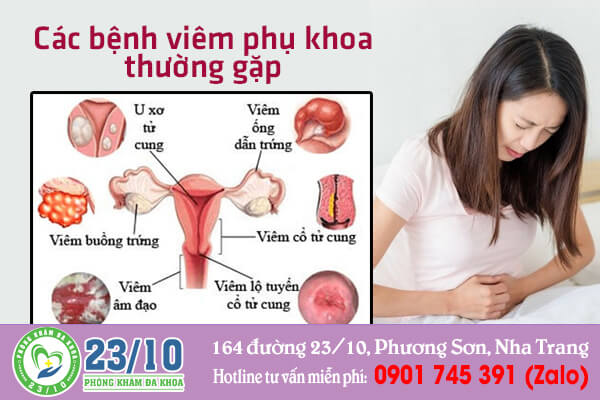 Các bệnh viêm phụ khoa thường gặp