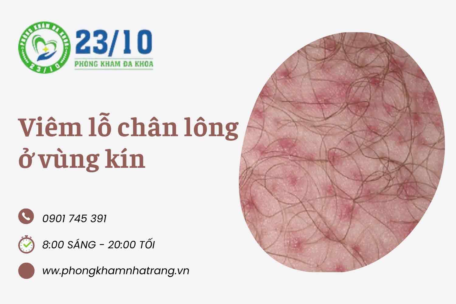 Những nguyên nhân phổ biến gây viêm nang lông